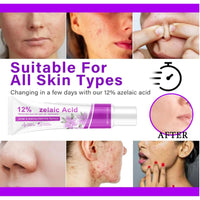 MEITREND Acid 12% Facial Serum,2PCS Rosacea Treatment for Face,Anti Acne Cream for Women & Men,Anti Redness Cream for Face,Reduce Acne & Removes Redness,Skin Care Gel