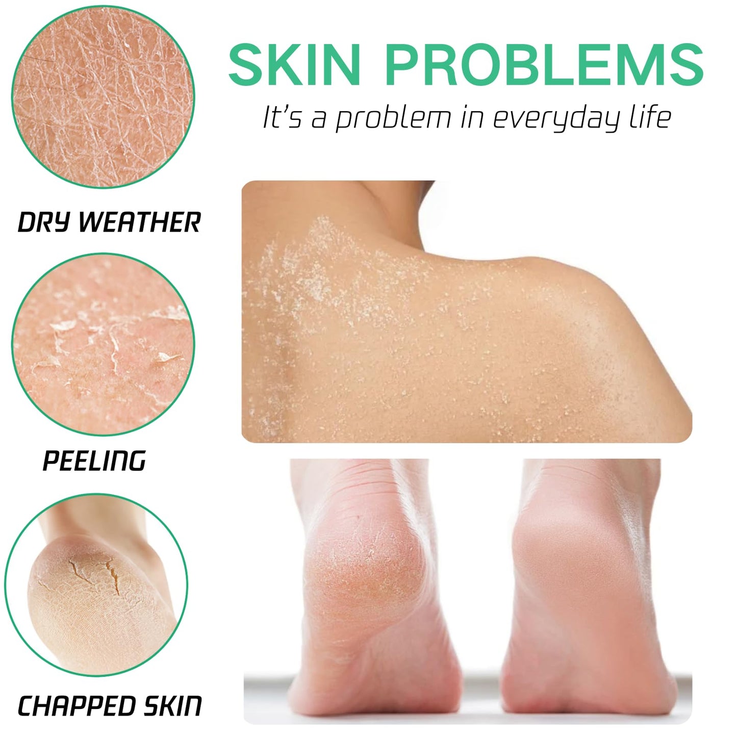 ISBEAUSOLS 40% Urea Foot Cream - Ultra Moisturizing Urea Foot Cream Plus Deeply Hydrating - 2% Salicylic Acid Urea Cream - Foot Cream for Cracked Heels and Dry Skin - Nourish Foot Moisturiser 150g