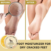Shefave 3PCS Natural Lanolin Cream for Hands & Foot,Foot Moisturizer for Dry Cracked Feet/Skin,Lanolin Nipple Cream Lip Balm for Discomfort &Eczema,Skin Barrier Repair Skin Cream Multi-Purpose Soothing Lotion