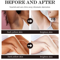 30ml Skin Bleaching Cream,Skin Brithening Cream for Face and Body,Intimate Area Dark Spot Corrector,Bikini Lightening Cre/am,Inner Thigh Lightening Crea/m for Darkskin,Improve Dullness & Hydrating