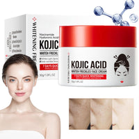 Kojic Acid Cream,Skin Lightening Cream for Anti Aging,Dark Spot Correcting Glow Serum,Dark Spot Corrector,Dark Spot Remover for Face,Spot Cream,Face Moisturizer for Women,Dark Spot Cream,Spot Gel