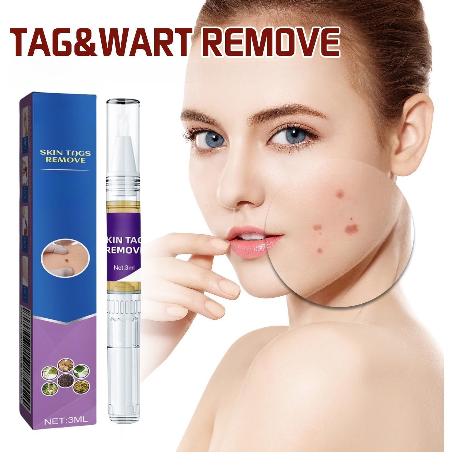 Jinjiar 2PCS Wart Remover Pen,Skin Wart Remover,Fast-Acting Wart Removal,Wart Freeze Removal,Foot & Hand Wart Strong Remover,Mole Remover,Natural Wart Re-Mover,Wart Re-Mover for Face,Flat Wa-rt Remover