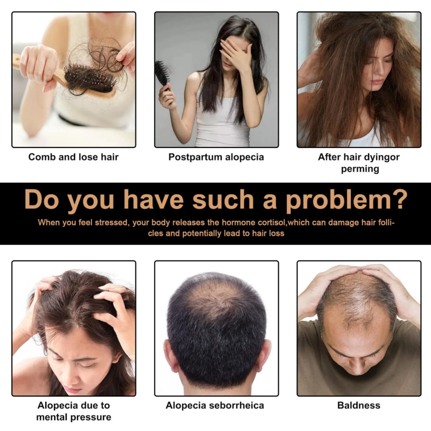 SingHao Spa/rtan Root Activator Shampoo,Unisex Hair Loss Shampoo,Spa/rtan Hair Sh/ampoo,Ma/ne Root Activator Sha/mpoo,H/air Thickening Sha/mpoo,Spar/tan Natural He/rbal Essence Ha/ir Growing Sham/poo