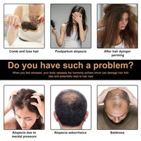 SingHao Spa/rtan Root Activator Shampoo,Unisex Hair Loss Shampoo,Spa/rtan Hair Sh/ampoo,Ma/ne Root Activator Sha/mpoo,H/air Thickening Sha/mpoo,Spar/tan Natural He/rbal Essence Ha/ir Growing Sham/poo