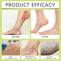 SingHao Miracle Balm,Miracle Soothing Cream,Muscle Pain Relief Cream,Herbal Balm for Legs,Moisturizing Pain Relief Crea/m,Fast Absorbing Body Cre/am,Targeted Pain Relief for Muscles,Fast Acting&Gentle