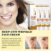 SingHao 3PCS Bee Venom Wrinkle Removal Cream,Bee Ven/om Anti-Wrinkle Cre/am,An/ti Wrin/kle Firming Multi Purpose Cr/eam,Anti Wrink/le Face Moisturizer,Be/e Ve/nom Skin Treatment Cream,Moisturizer C/ream