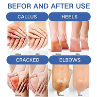 MrCuvaryas Urea Cream 60 Percent for Feet Set, Urea Foot Cream for Cracked Heels and Dry Skin, Cracked Heel Repair Cream For Feet and Hand and Body Care Hydrates, Softens & Exfoliates Women & Men