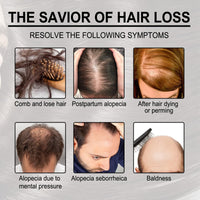 Oumun Deoxyribose Sugar Gel Hair Growth,Sugar Hair Growth Serums,Hair Serum for Hair Gro/wth,Hair Thickening Essence,Ha/ir Breakage Treatment,Ha/ir Oil for Dry Damaged Ha/ir,Deeply Nourish and Repair