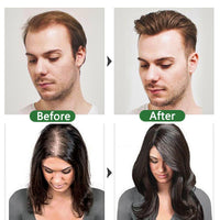 AmiCera Rosemary Oil for Hair Growth, Organic Pure Rosemary Essential Oil, with Derma Roller for Hair, Hair Strengthening for Men Women, Scalp Massage & Nourish, Eyebrow Eyelash Growth Oils, 60ml, 2 Brushes