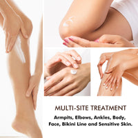 Niacinamide Treatment Cream, Dark Spot Remover Cream for Dark Knuckle, Knees, Elbows, Thighs, Armpit, Neck, Intimate, 4.2 FL.OZ