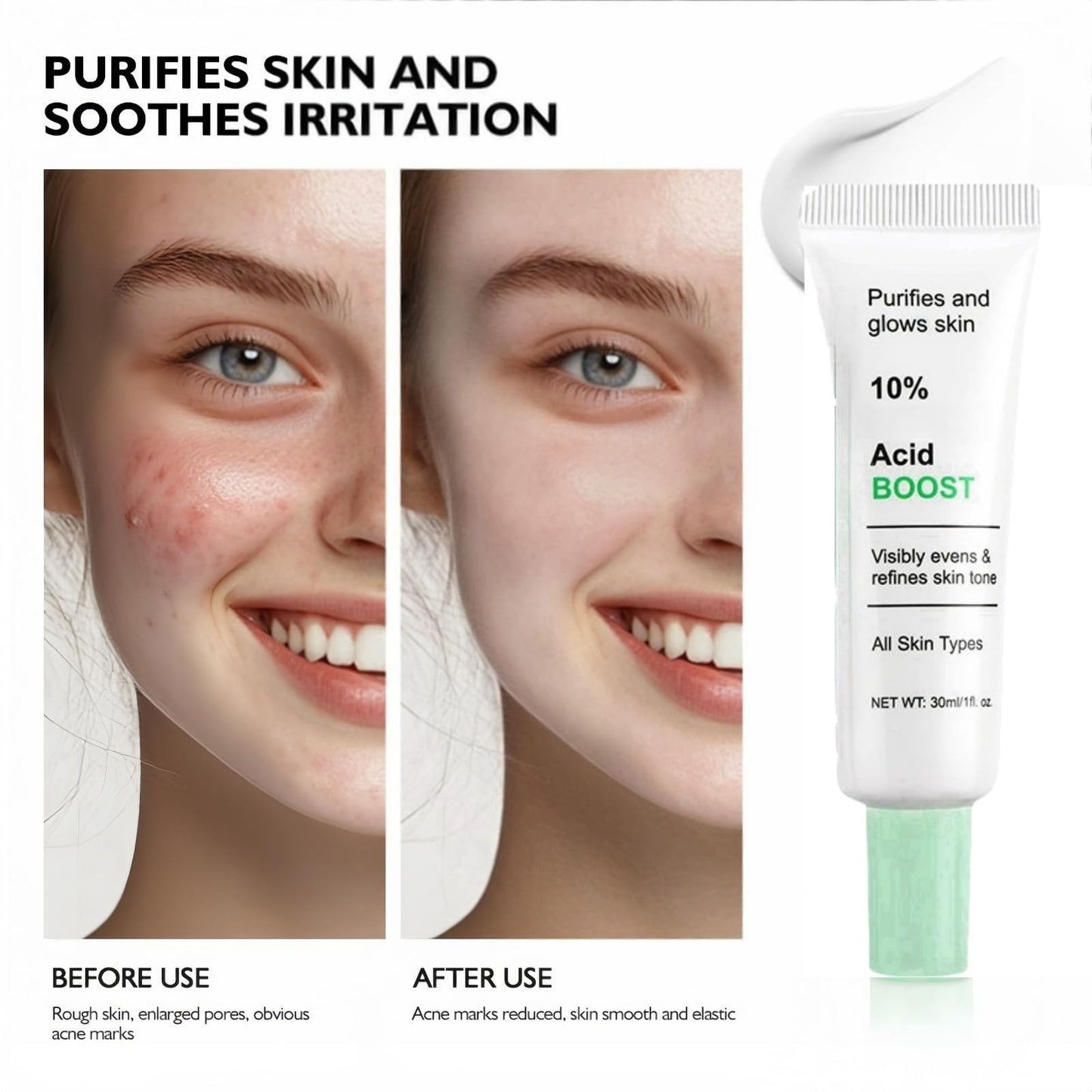 Oumun 10% Azlaic Acid Booster Cream Gel,Azlaic Acid Cream for Face,A/zlaic A/cid Cr/eam 10%,A-zlaic Ac-id Gel,Acne Treatment Cr-eam,Acne Cre-am,Skin Tightening Crea-m for Fa-ce,Azlai-c Aci-d Serum