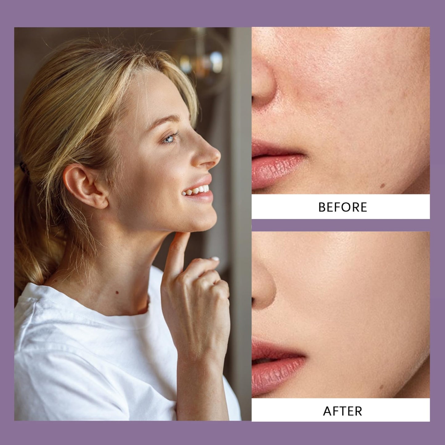 SHEBEEDO Body Coverage Perfector with Brush,Radiant Glow Tattoo Cover Up Makeup,Long-Lasting Waterproof All-Over Complexion Perfector,Leg Makeup to Cover Veins All In One Moisturiser Concealer