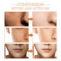 Organic Paracress Facial Oil,Paracress Facial O-il,Anti-Aging Paracr-ess Oi-l for Face,Para-cress Fac-ial Oi-l Ser-um,Parac-ress Anti Wrinkle Seru-m,Fac-e Seru-m,Moisturiser Fac-e,Anti Aging Serum