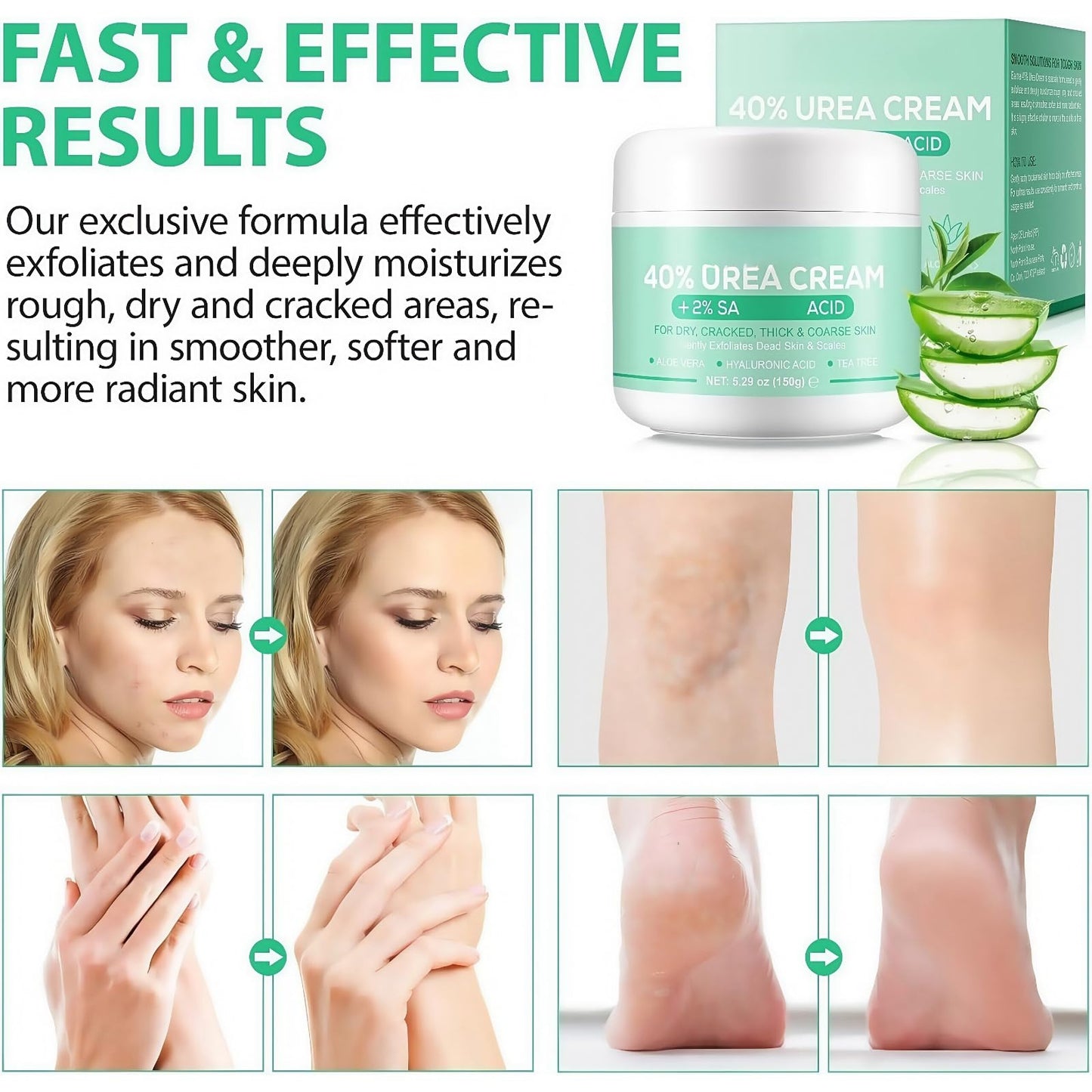Jinjiar Urea Foot Cream,Urea Foot & Hand Cream for Dry Cracked,Cracked Heel Repair Cream,Fo-ot Cream for Cra-cked Heels and Dry Skin,Foot Moisturiser for Dry Cra-cked Feet,Fo-ot Peel,Fo-ot Care Products