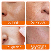 L0famy 50Pcs Turmeric Kojic Acid Pads, Exfoliating Face Cleansing Cotton Pads, Kojic Acid and Turmeric Pads, for Face, Body, Acne, Dark Spots, Hyperpigmentation, Smooth Skin