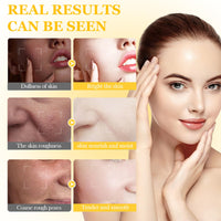 ISBEAUSOLS Tumeric Face Cream For Skin Tightening - Turmeric-Infused Dark Spot Remover - Anti-Aging Day Moisturiser for Sensitive Skin - Pigmentation Removal with Hyaluronic Acid