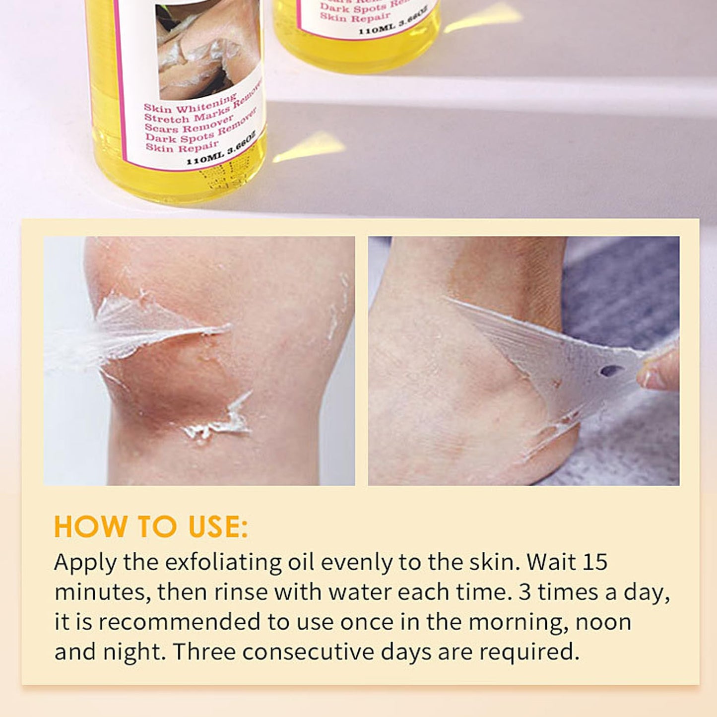 Yellow Peeling Oil - Lightening Exfoliating Dark Skin For Body, Strong Peeling Oil, Skin Peeling Oil For Skin Lightening, Peeling Oil For Skin Brightening Moisturizing, Peeling Solution Dark Skin