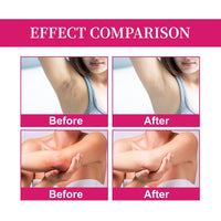 Sakura Brightening Gluta Underarm Cream,Underarm Whitening Cream,Whitening 50X Pearl Cap/Sules,Armpit Booster Serum,Body Whitening Cream for Dark Skin,Skin White-ning Cr-eam for Suit All Skin Types