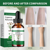 AuraBeen Cyperus Rotundus Oil - Nut Grass Extract, 60ml Body Skin Nurturing Serum for Gentle Care