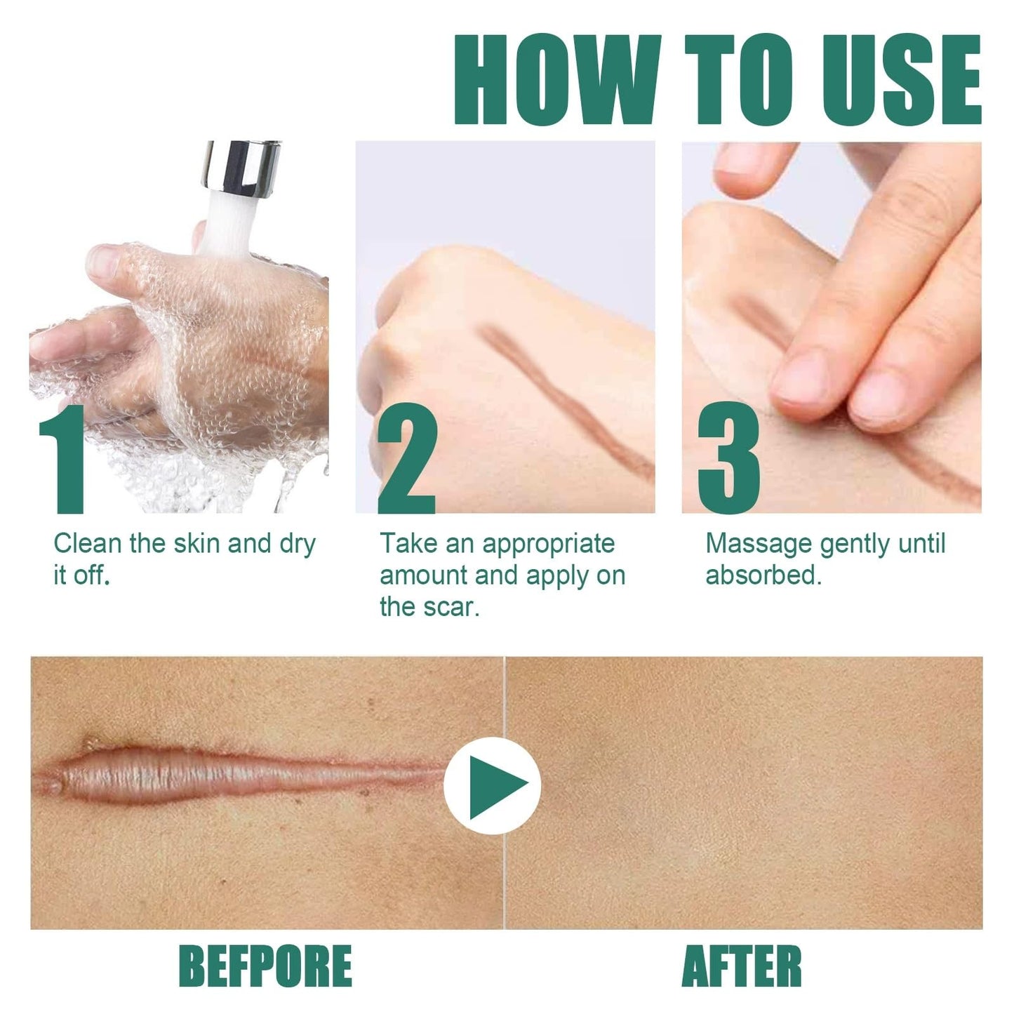 Jinjiar Scar Removal Set with Repair Scar Cream & Serum,Scar Removal Cream,Scar Treatment,Advanced Scar Gel for Old and New Scars,Scar Crea-m After Surgery,S-car Healing Cre-am,Acne Sc-ar Treatment,Scar Away