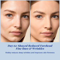 ANAI RUI ANAiRUi Matrixyl 3000 & Argireline Anti-Aging Face Serum with Peptide, Hyaluronic Acid, Against Wrinkles, Boost Collagen & Hydrate Skin | Fast-Absorbing Formula for Mature & Dry Skin | 30ml