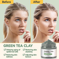 Face Masks Skincare, Clay Mask Kit, 3-Set Turmeric Vitamin C Clay Mask, Dead Sea Mud Mask, Green Tea Deep Cleanse Mask for Detoxing, Reducing Acne, Oil Control, Dark Spots, Pores and Blackheads