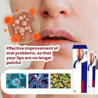 Cold Sore Cream,Cold Sore Treatment Cream,Mouth Ulcer Treatment for Adults,Gentle Sore Lips Treatment,Mouth Sore Treatment for Lips,Mouth Ulcer Gel,Fresh and Non-irritating,Natural Ingredients,20g
