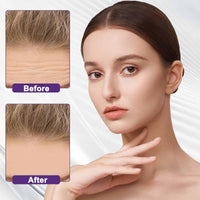Forehead Wrinkle Patches,Forehead Patches For Wrinkles Forehead Patches For Line Remover Patches Smoothing Facial Anti-Wrinkle Patches Moisturizing Mask Pads For Women Age Lines Resistant Patches
