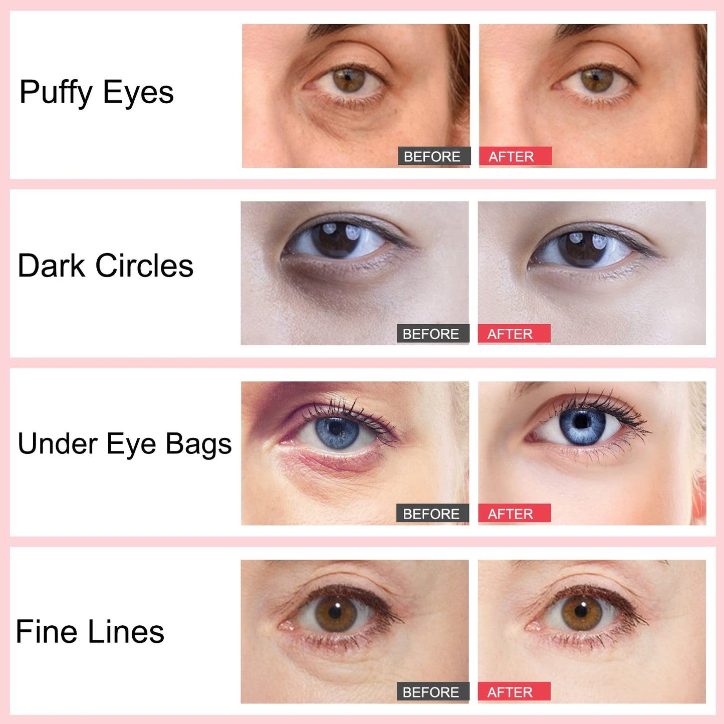 Generic Retinol Eye Stick, Eye Cream For Dark Circles And Eye Puffiness, Hydrates, Firms, Brightens, Fine Lines, For All Skin Types 3G (Retinol)