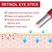 SingHao Retinol Eye Stick,Retinol Eye Cream for Dark Circles,Under Eye Cream Anti Aging,Eye Cre/am for Puffiness,Reducing Fine Lines,E/ye Balm Stick,E/ye Brightener Sti/ck,Smoothens Wrinkle E/ye Cre/am