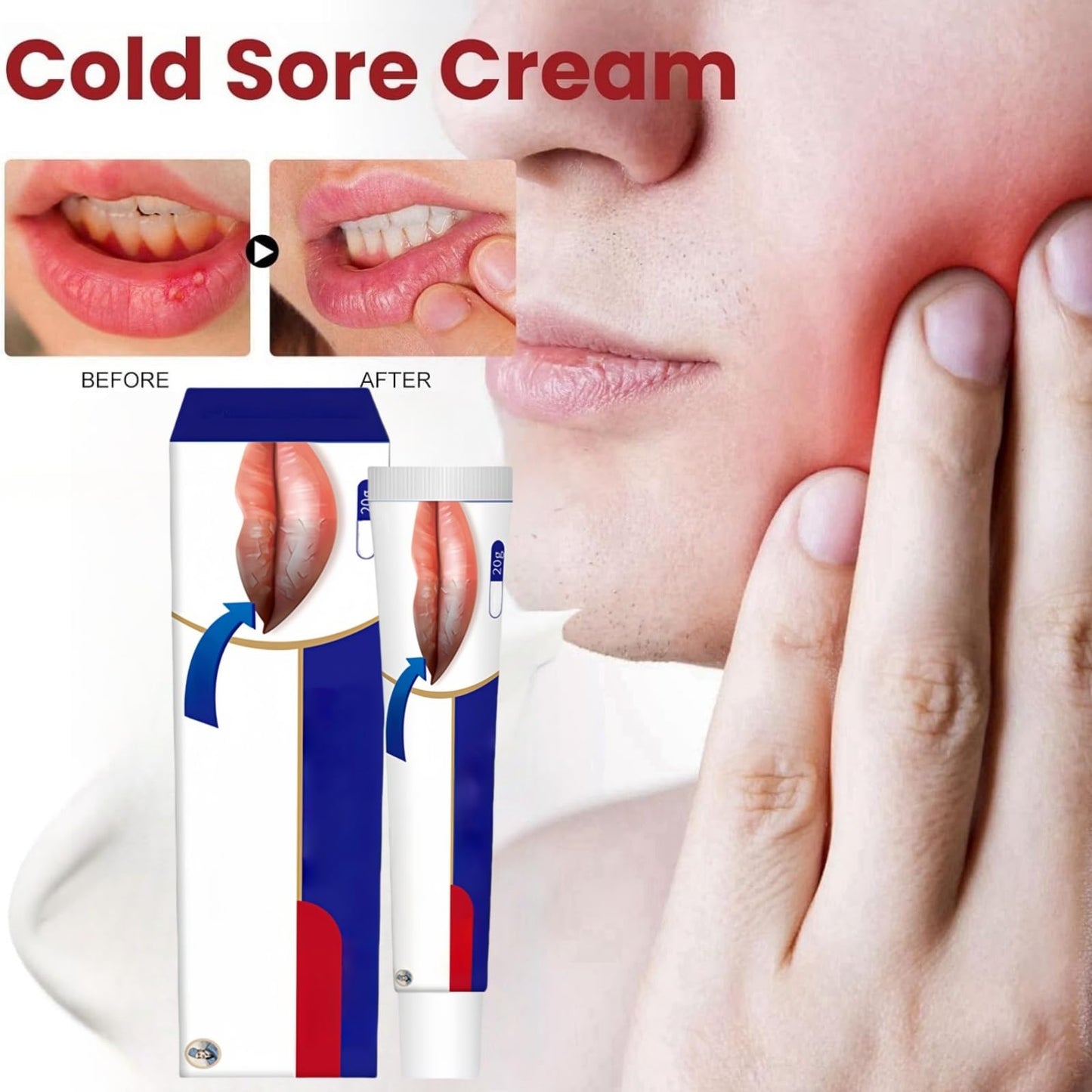 Cold Sore Cream,Cold Sore Treatment Cream,Mouth Ulcer Treatment for Adults,Gentle Sore Lips Treatment,Mouth Sore Treatment for Lips,Mouth Ulcer Gel,Fresh and Non-irritating,Natural Ingredients,20g
