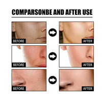 Siyinzu Dark Spot Correcting Glow Serum,5% Niacinamide Serum,Brightening Dark Spot Ser/um,Dar/k Spo/t Remover for Face,Anti-Aging Ser/um,Hydrating Facial Se/rum,Skin Care S/erum for Age/Sun Spots/Acne Marks