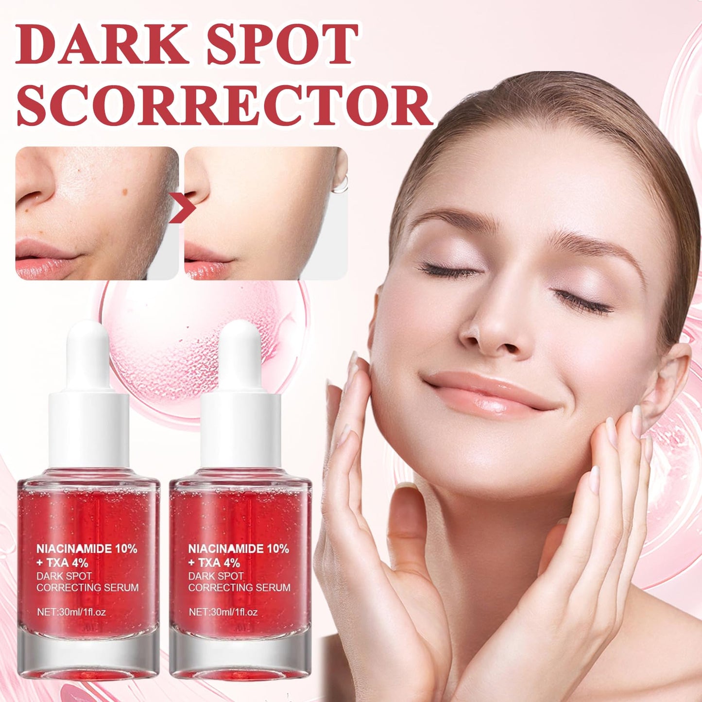 Belligern 2Pcs Dark Spot Correcting Serum,Niacinamide Serum Niacinamide Dark Spot Correcting Serum Targets Signs of Acne With 10% Niacinamide + 4% Tranexamic Acid Even Skin Tone,Fragrance-Free