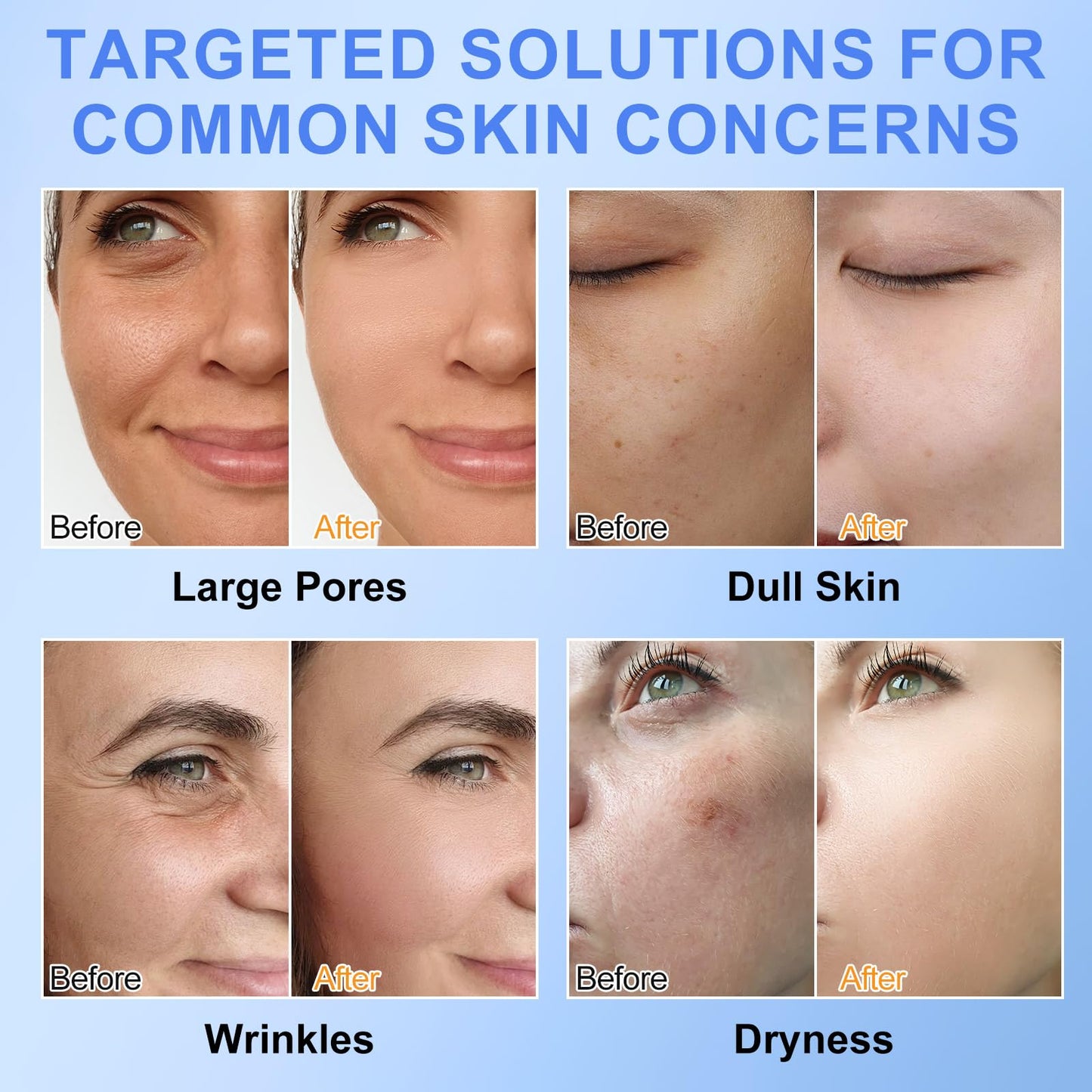 Bio Collagen Face Mask 6pcs, Intense Hydration, Reduce Fine Lines & Wrinkles, Soothing & Hydrating Overnight Hydrogel Mask, Pore Minimizing, Elasticity Improvement, Anti Aging and Rejuvinating Sheets