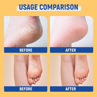 Urea Cream 60 Percent For Feet - 2PCS Urea Foot Cream For Cracked Heels And Dry Skin With 2% Salicylic Acid - Foot Cream for Cracked Heels and Dry Skin Cracked Heel Repair Cream Foot Moisturiser Balm