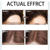 Shengqialun Root Cover Up Powder, Hairline Powder Dark Brown, Hair Root Colour Touch Up Instantly, Hair Roots Concealer Waterproof & Sweatproof, Grey Hair Cover Up For Women Men