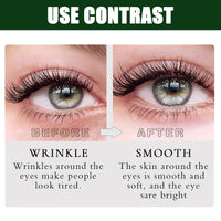 Coloroom Collagen Under Eye Gel Patches for Puffy Eyes & Dark Circles, Hydrating Eye Patches for Bags & Wrinkles, Moisturising Under Eyes Patch – Skincare for Women