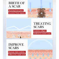 ZQUKAMZ Scar Cream Advanced Scar Gel Cream for Surgical Scars, Stretch Mark,Acne, Injury, Keloids, and More, Effective for Both Old and New Scars Professional Scar Removal Cream (Blue)