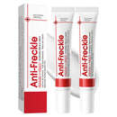 MINSHZEE Freckle Removal Cream - Removes facial dark spots, Dark Spot Remover with Niacinamide and Vitamin C, Improves dull skin (2 piece)