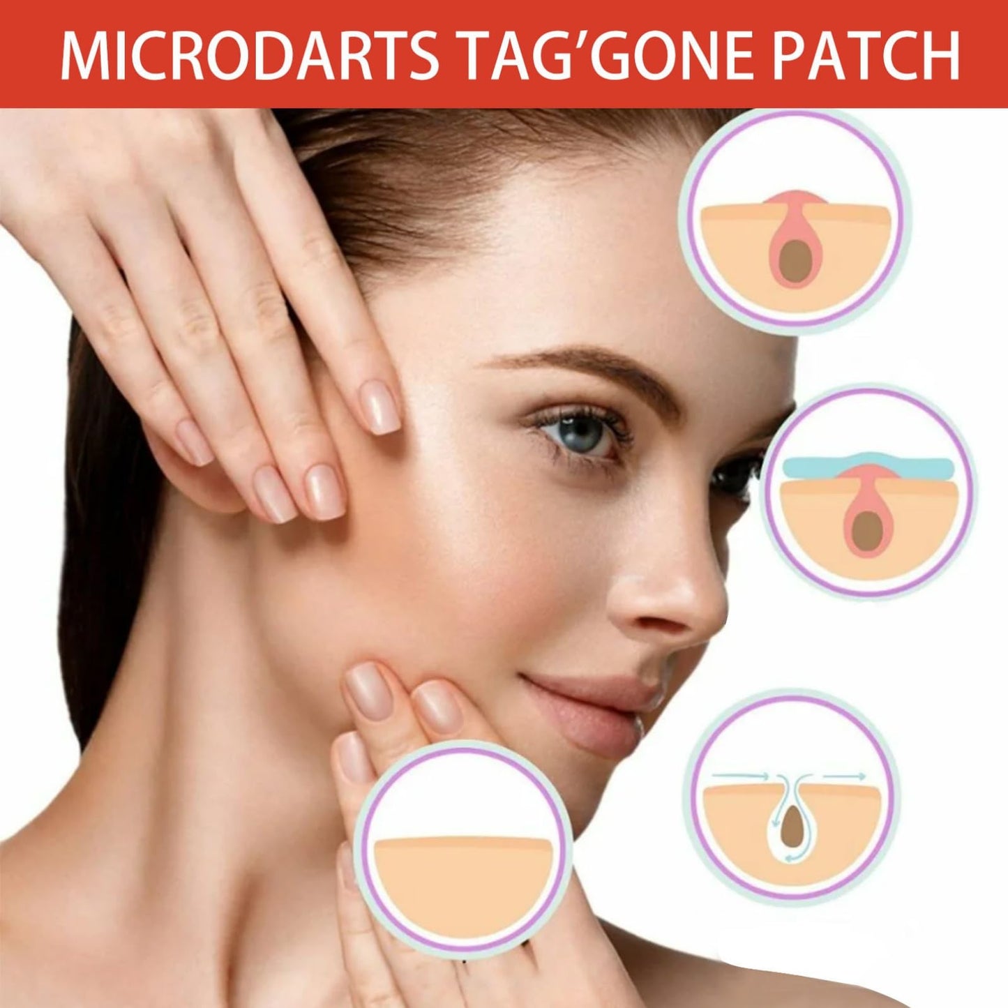 SingHao 144 Pcs Microdarts Tag'gone Patch,Pimple Patches,Spot Patches,Acne Treatment,Invisible Blemish Cover Spot Sticker,Patches Pimple Stickers Acne Dots,Pimple Spot Stickers Day&Night Use(144Pcs/box)