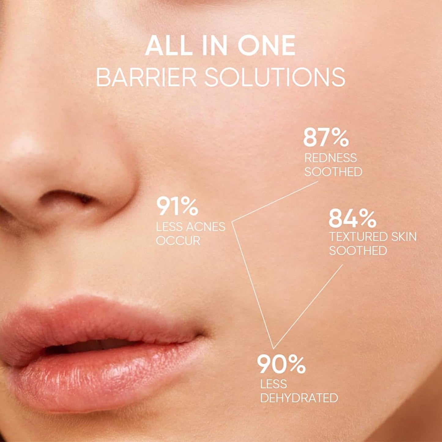 5X Ceramide Barrier Cream, Ceramide Moisturiser, Skin Barrier Repair Cream, Hyaluronic Acid Moisturiser Face Women With Centella - Hydrating Soothes Redness & Acne Barrier Repair Anti Aging Face Cream