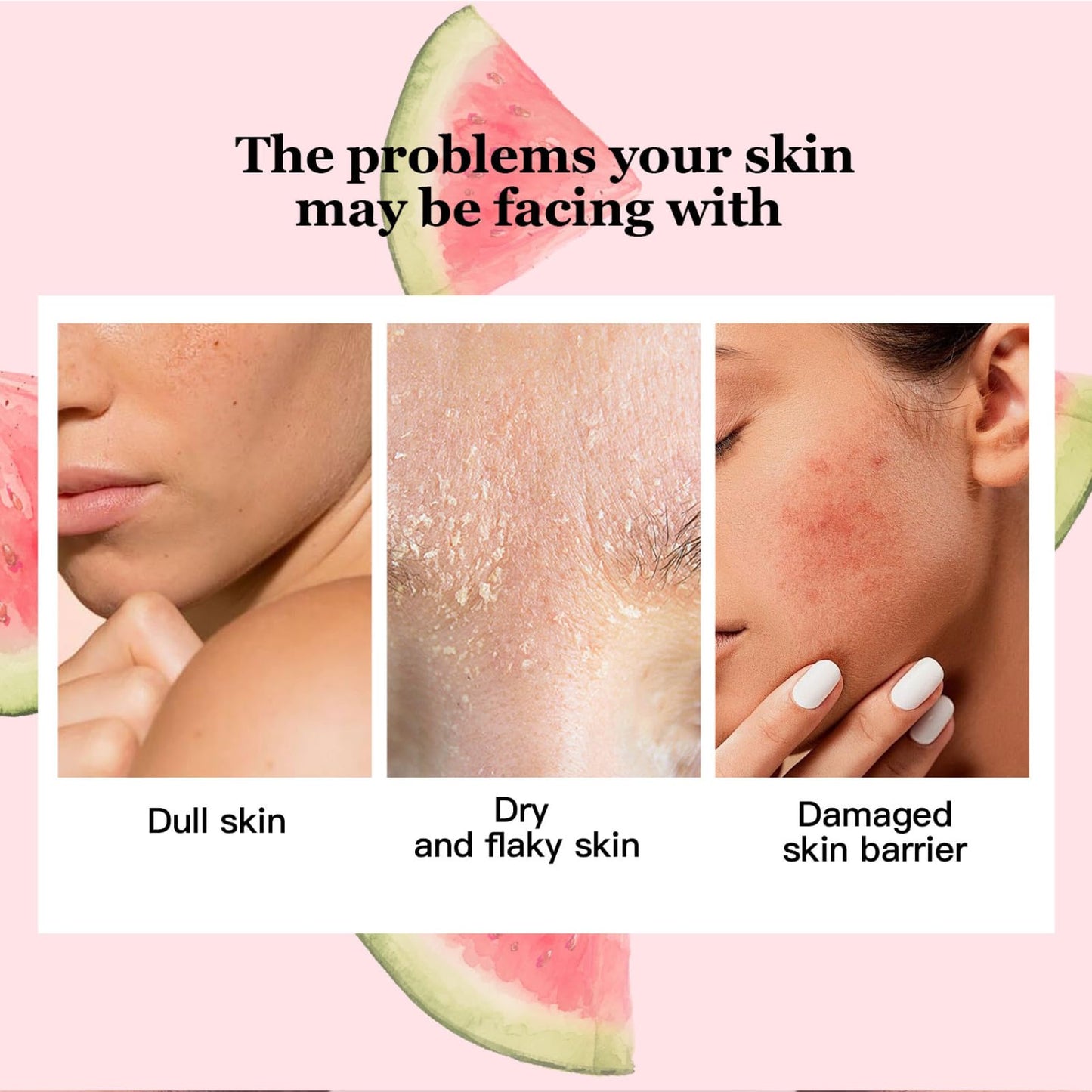 Watermelon Niacinamide Serum for Hydration, Hydrating Serum with Watermelon Extract for Radiant Glow, Niacinamide Serum for Glowing Skin, Moisturising Face Serum with Watermelon to Repair and Brighten