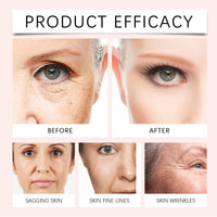 SingHao Anti-Wrinkle Wrinkle Filler Serum,Instant Wrinkle Remover for Face,Wrink/le Filler Serum,Power Redo Wrin/kle Fix,Advanced Anti-Aging Cream,Wrin/kle Blur Cream,Peptides Reduces Fine Lines,Grips Makeup