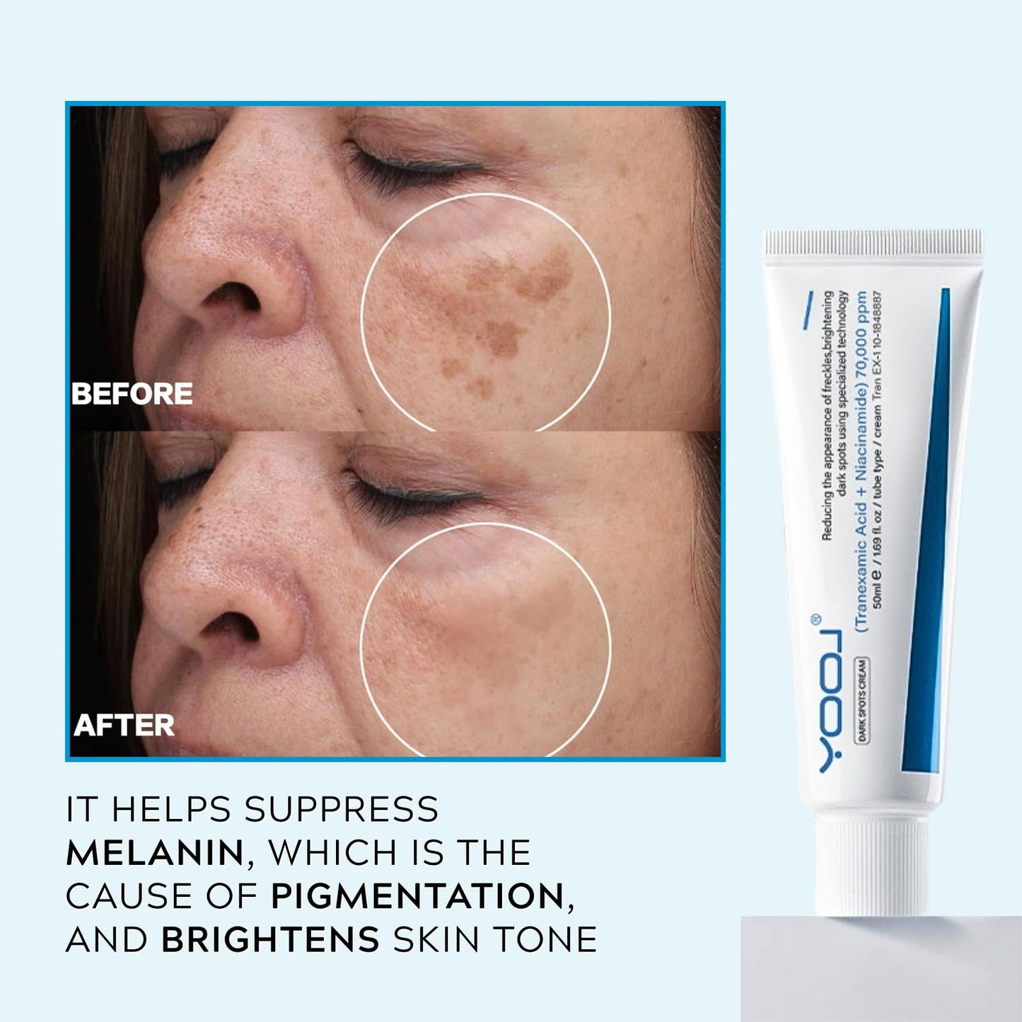 Dark Spot Remover for Face Cream, Niacinamide + Tranexamic Acid Cream for Freckles, Hyperpigmentation, Age Spots, Blemishes, Melasma, Dark Spot Cream, Korean Skin Care, 50ml