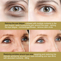 Xunzhi Dissolving Microneedle Eye Patches,Anti Wrinkles Micro Needle Patches,Dissolving Microneedle Wrinkle P/atches,Anti Wrinkle P/atches for Dark Circle,Under Eye Pa/tches,Dissolving Microneedle E/ye Mask