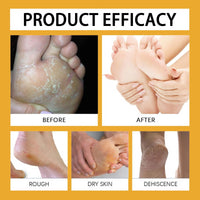 Foot Cream, Heel Creams For Cracked Heels & Dry Skin, Cracked Heel Repair Creams, Honey Moisturizer With Gentle Ingredients, Lightweight & Fast-Absorbing,3PCS Foot Cream Set