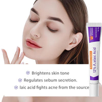 Acne Treatment for Spot Prone Skin,12% Acid Spot Cream,Anti Acne,Rosacea Cream for Face,Pimple Crea-m,Dark Spo-t Remover,Daily Face Moisturiser for Blemish Control,Blackhead Remover,Even Skin Tone