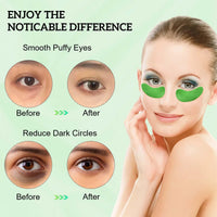 ProChosen 30 Pairs Collagen Under Eye Patches, Anti-Aging Eye Lip Facial Mask,Fade Eye Wrinkles Lip Lines, Under Eye Bags Removal and Anti Wrinkle, Skincare, Hydrating (Aloe Vera)