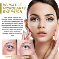 Fankayi Dissolving Micro-Needle Eye Patches,Anti Wrinkle Patches,Micro-Needle Patches for Dark Circles & Puffy Eyes,Under E-ye Gel Patches,Hydrating E-ye Patches,Hydro-gel E-ye Patches,E-ye Cooling Gel Pads