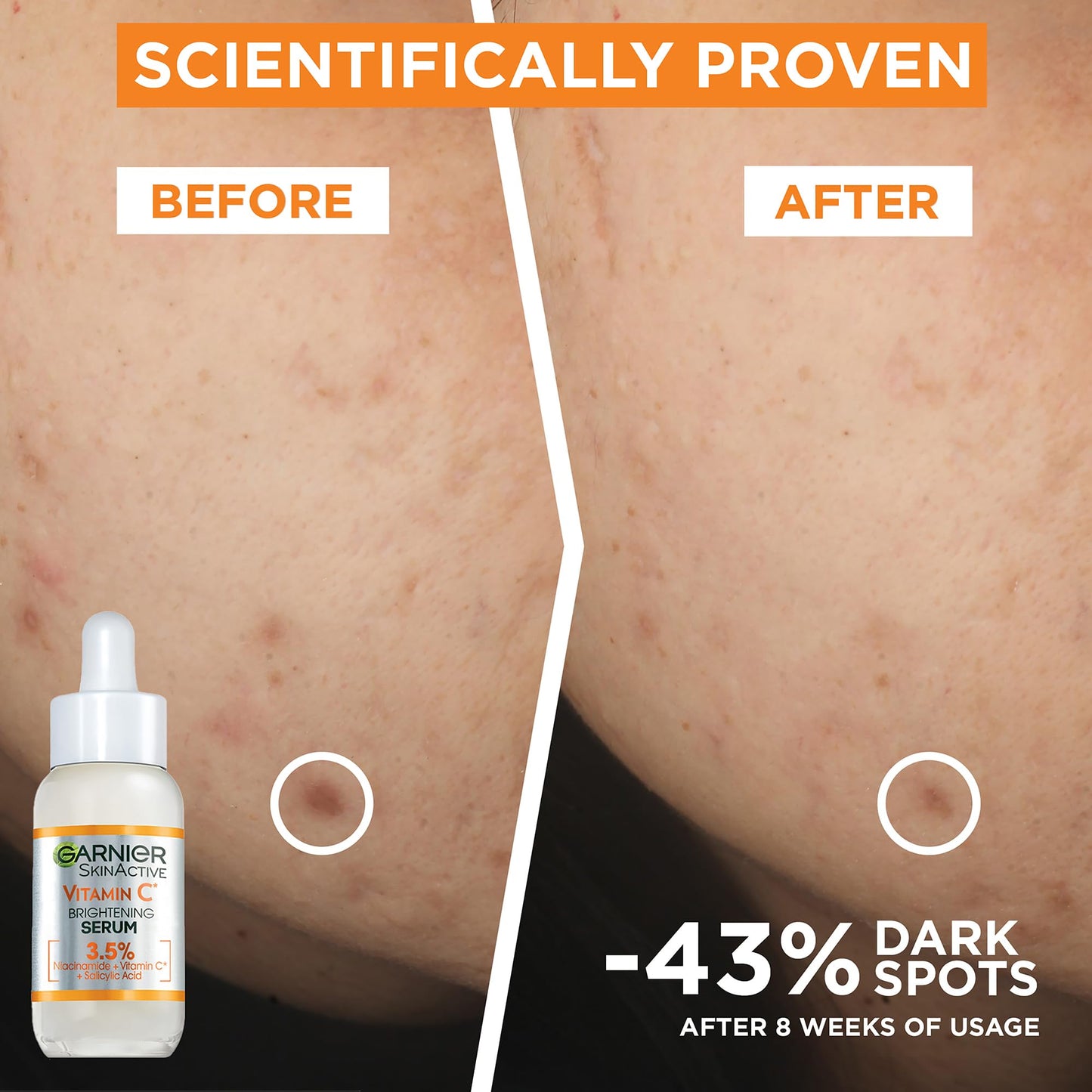 Garnier Naturals Vit C Anti-Dark Spot Serum 30Ml